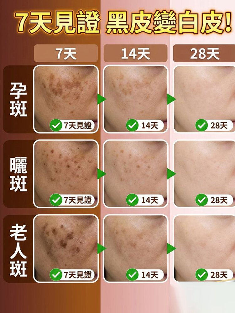 美白祛斑抗皺霜