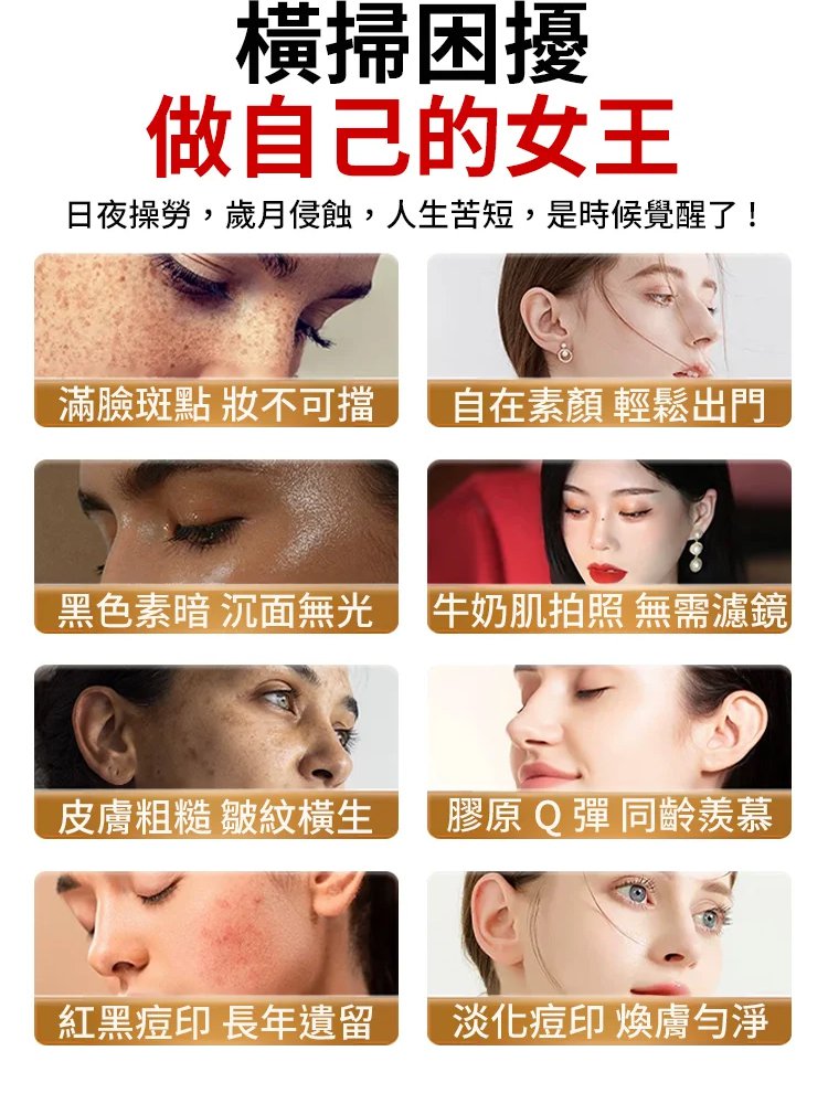 美白祛斑抗皺霜